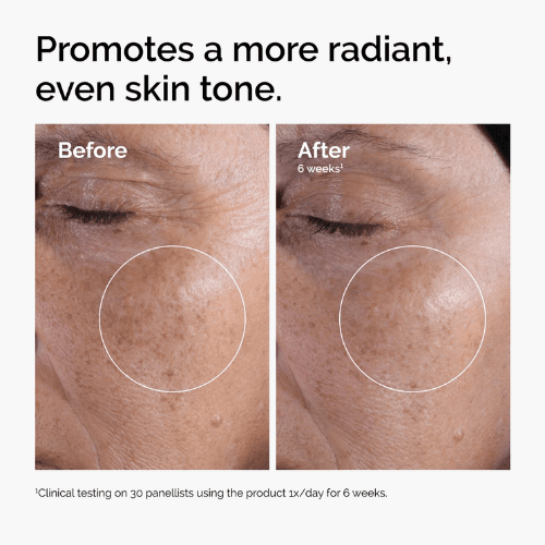 The Ordinary Glycolic Acid 7% Exfoliating Toner – Brightening & Smoothing Formula — image 6