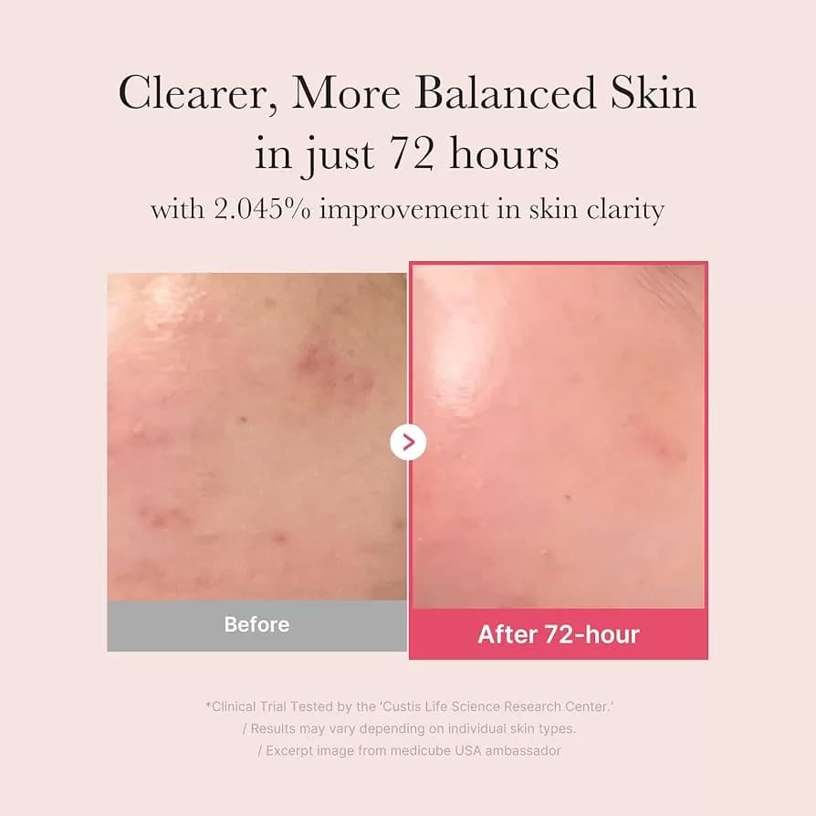 Medicube TXA Niacinamide 15 Serum — image 2